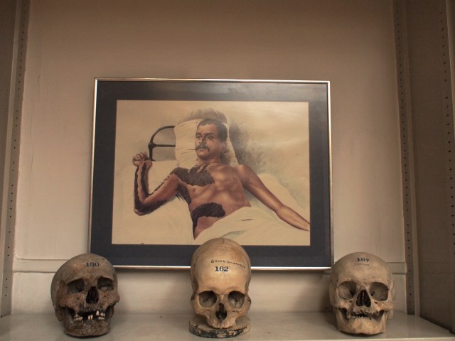 Barts Pathology Museum graciously lifted the prohibition on photography just for us. Photo by Megan Rosenbloom